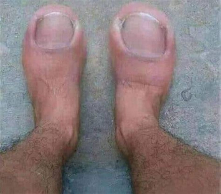 Ube One Big Natural Toes commercial And reality of bignaturaltoes.net